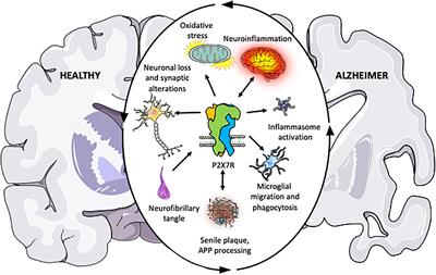 The Role of P2X7 Receptor in Alzheimer’s Disease